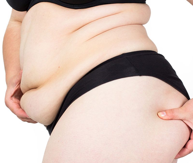 Qui peut bénéficier d’une chirurgie de l’obésité ?